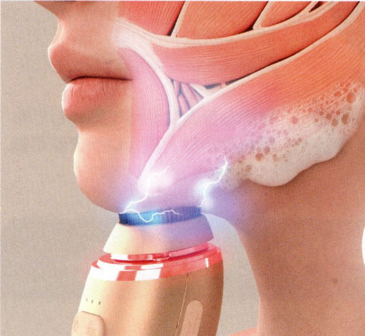 フェイシャルエステの写真