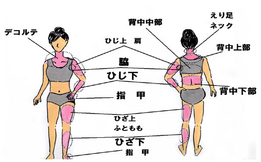 体・ムダ毛脱毛の写真
